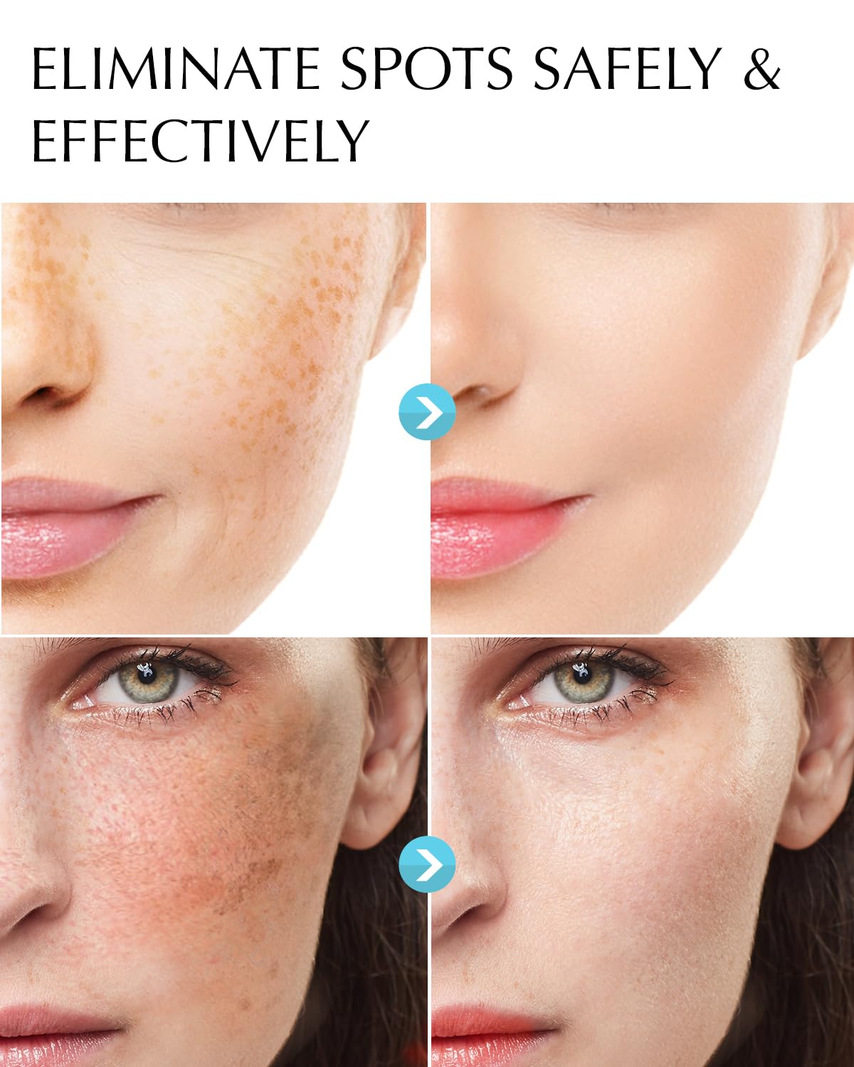 Dark Spot Remover for Face and Body: Hyperpigmentation Treatment - Natural Ingredient - Freckle/Melasma/Sun Spot/Age Spot Remover - Dark Spot Corrector Cream for Women and Men - Image 3