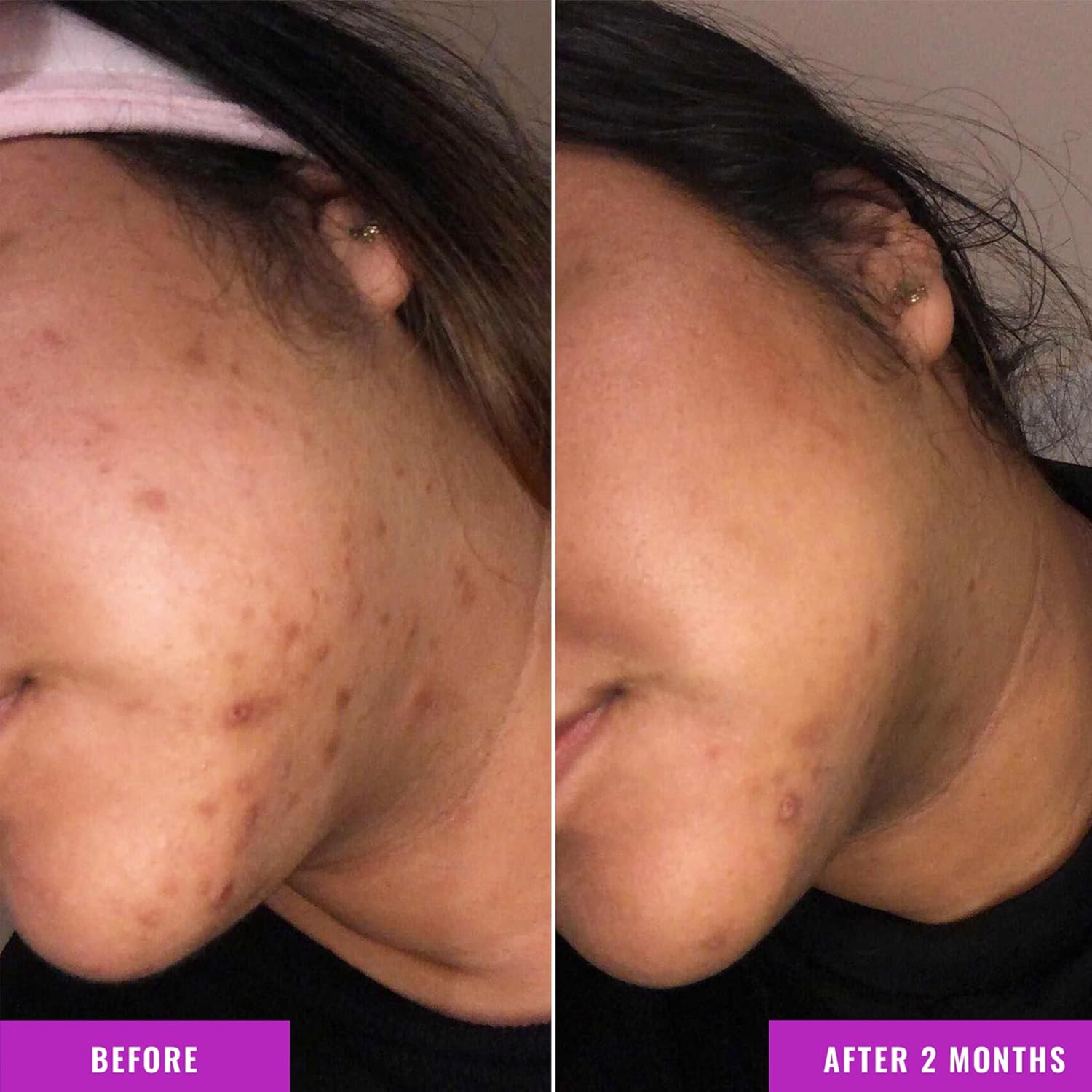 Good Molecules Discoloration Correcting Serum - Tranexamic Acid and Niacinamide Serum to Target Dark Spots and Hyperpigmentation - Skin Care for Face - Image 5